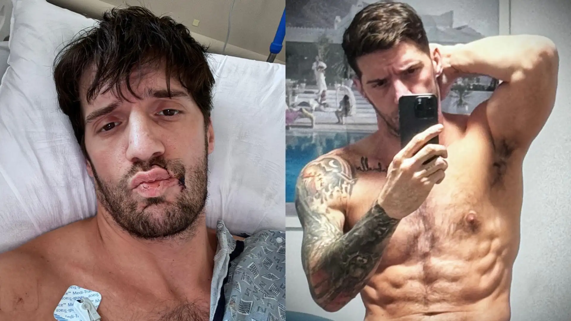 Ty Roderick Survives Shocking Knife Attack
