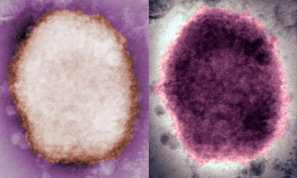 virus